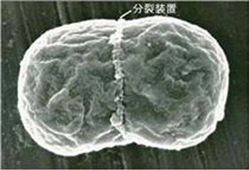 葉緑体の分裂装置による分裂像