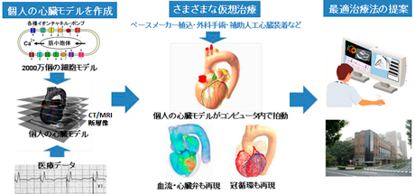 心臓シミュレーションによる最適治療の概念図