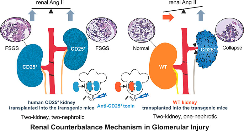 Experimental model demonstrating renal counterbalance in unilateral podocyte injury